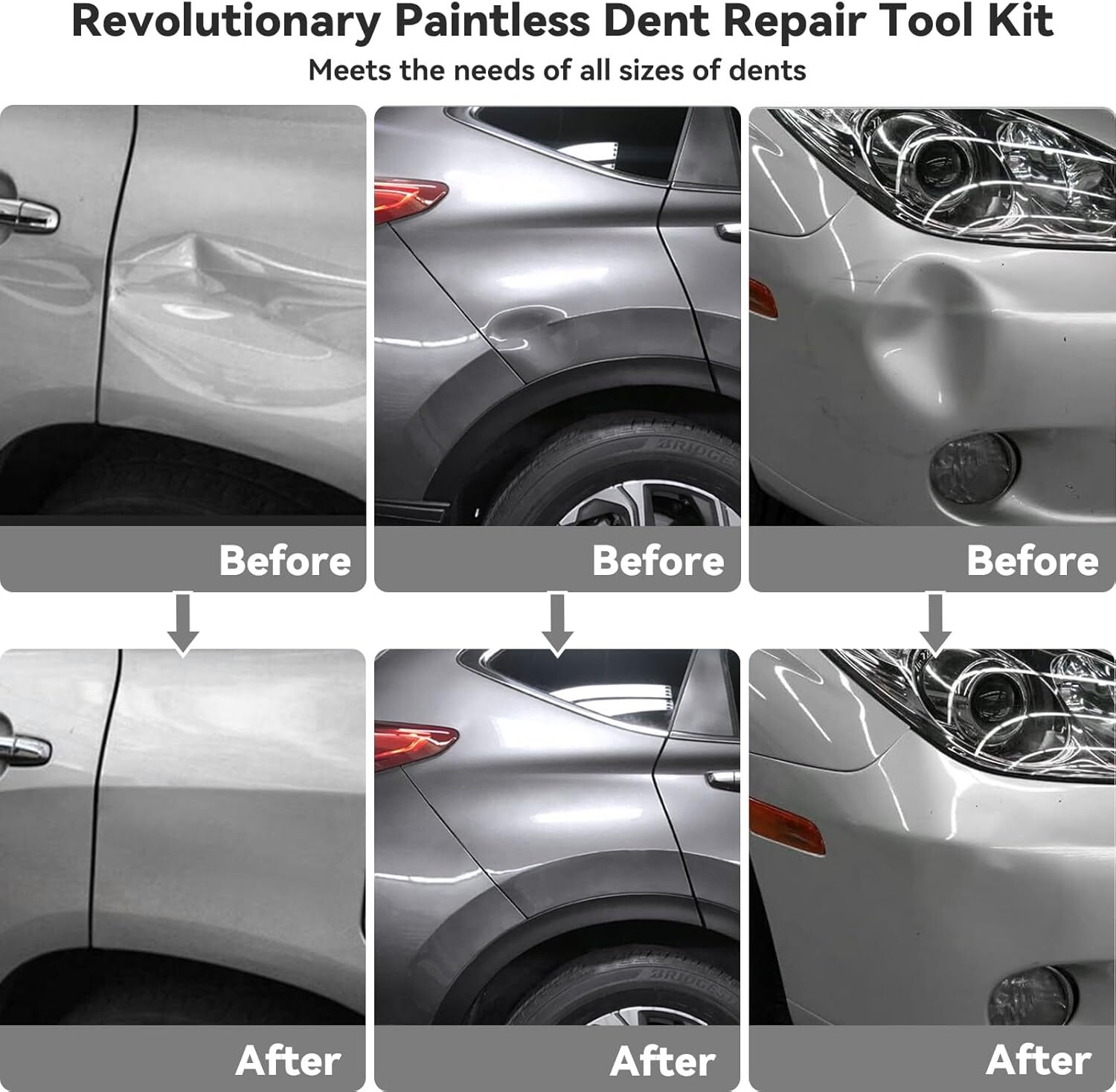 Paintless Car Dent Repair Kit Puller Removal Kit Hail Damage Remover Puller Tool