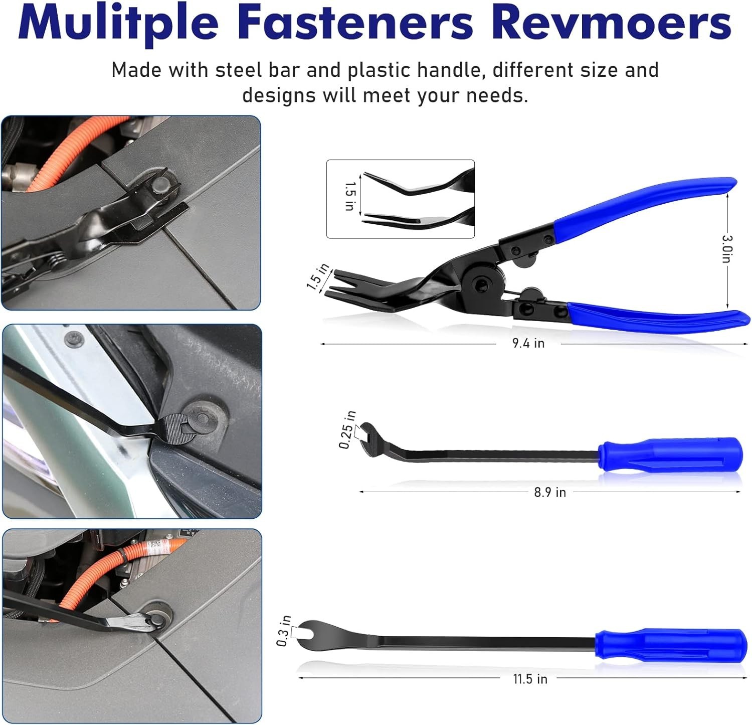Ergonomic 248-Piece Trim Removal and Fastening Tool Set – Perfect for Repairs